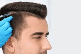 The Ultimate Guide to Hair Transplant in Dubai: A Step Towards Confidence